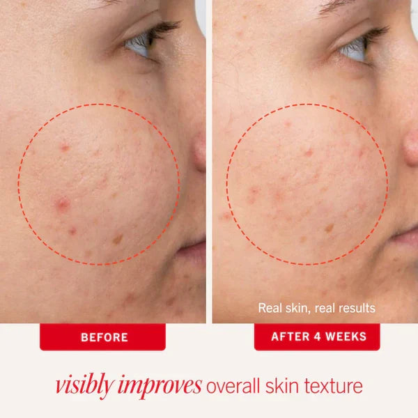 Clear Up + Hydrate Trio