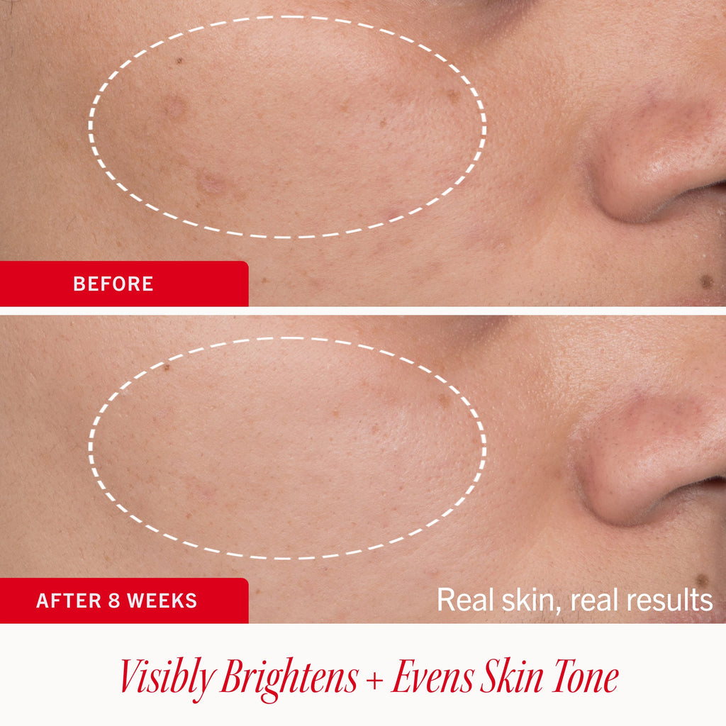 Dark Spot Serum with Niacinamide