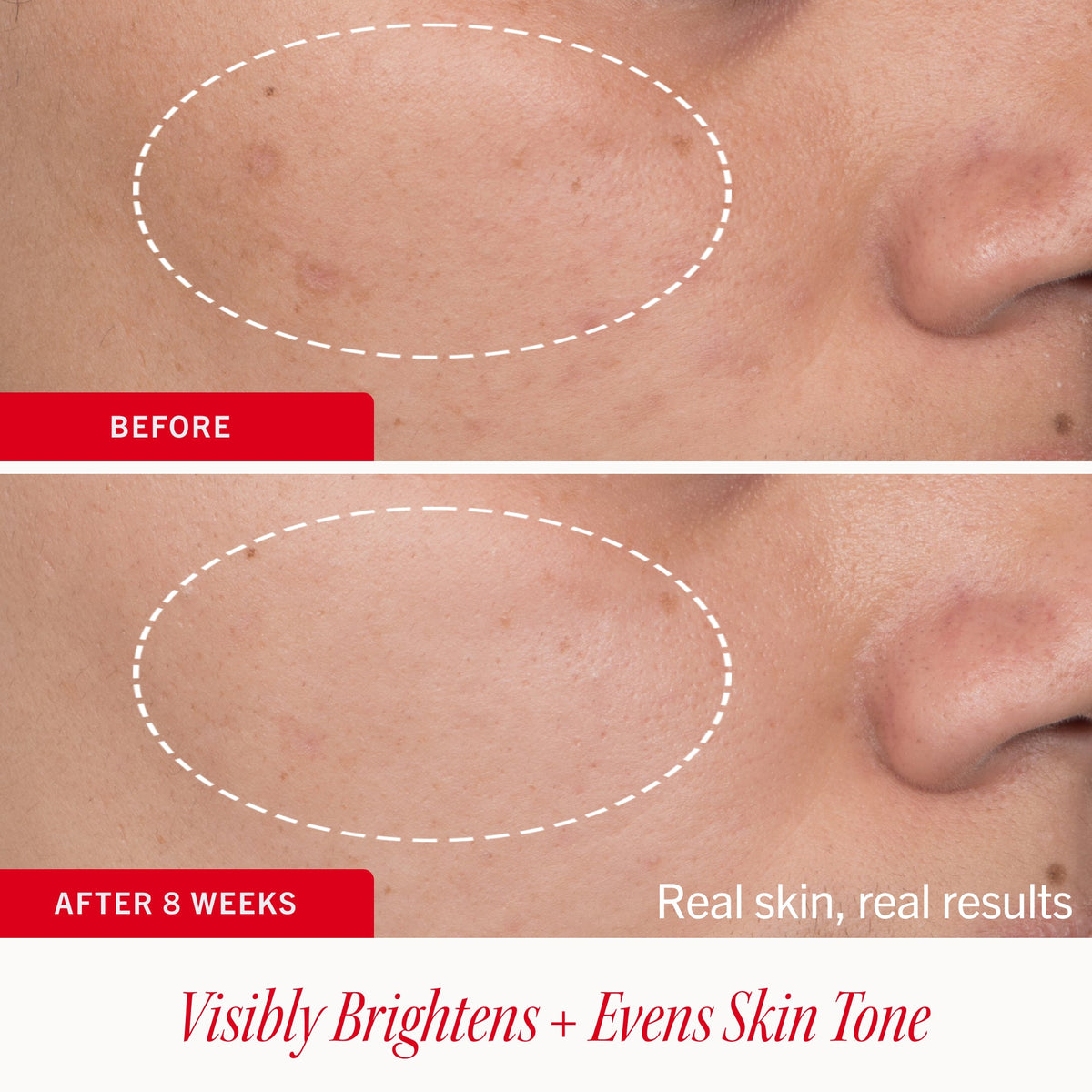 Dark Spot Serum with Niacinamide