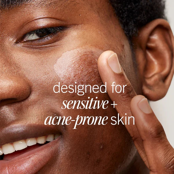 Ultimate Acne Solutions Routine