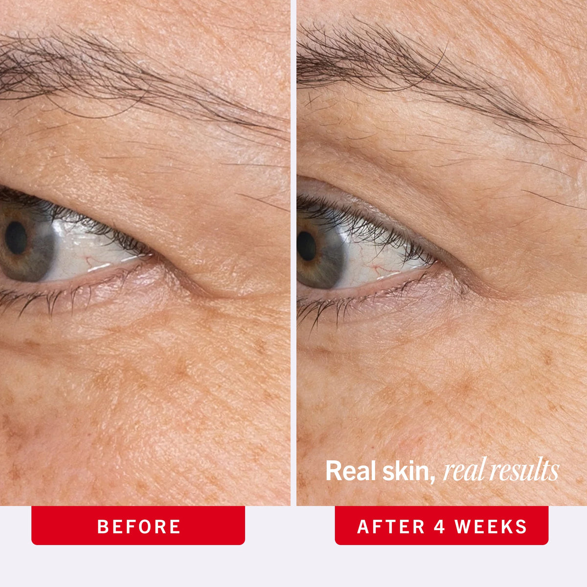 Ultra Repair Retinol Eye Cream with Retinol. Squalane + Ceramides