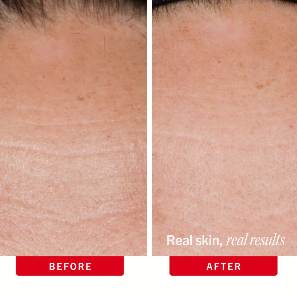 Dry Skin Duo