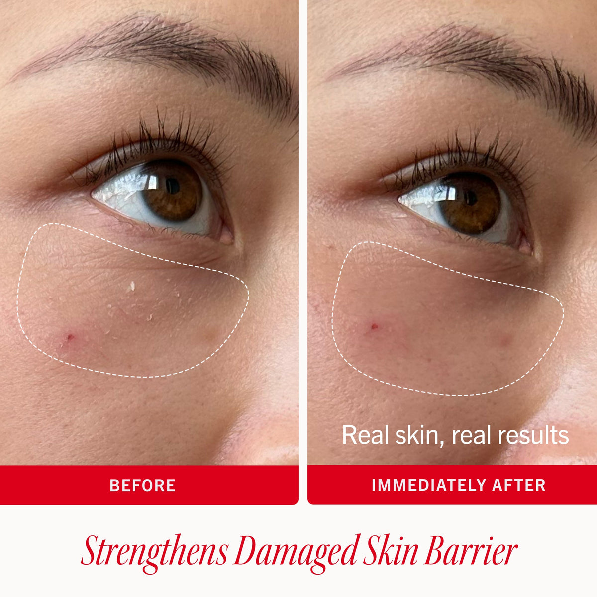 Ultra Repair Rescue Barrier Balm with Dimethicone