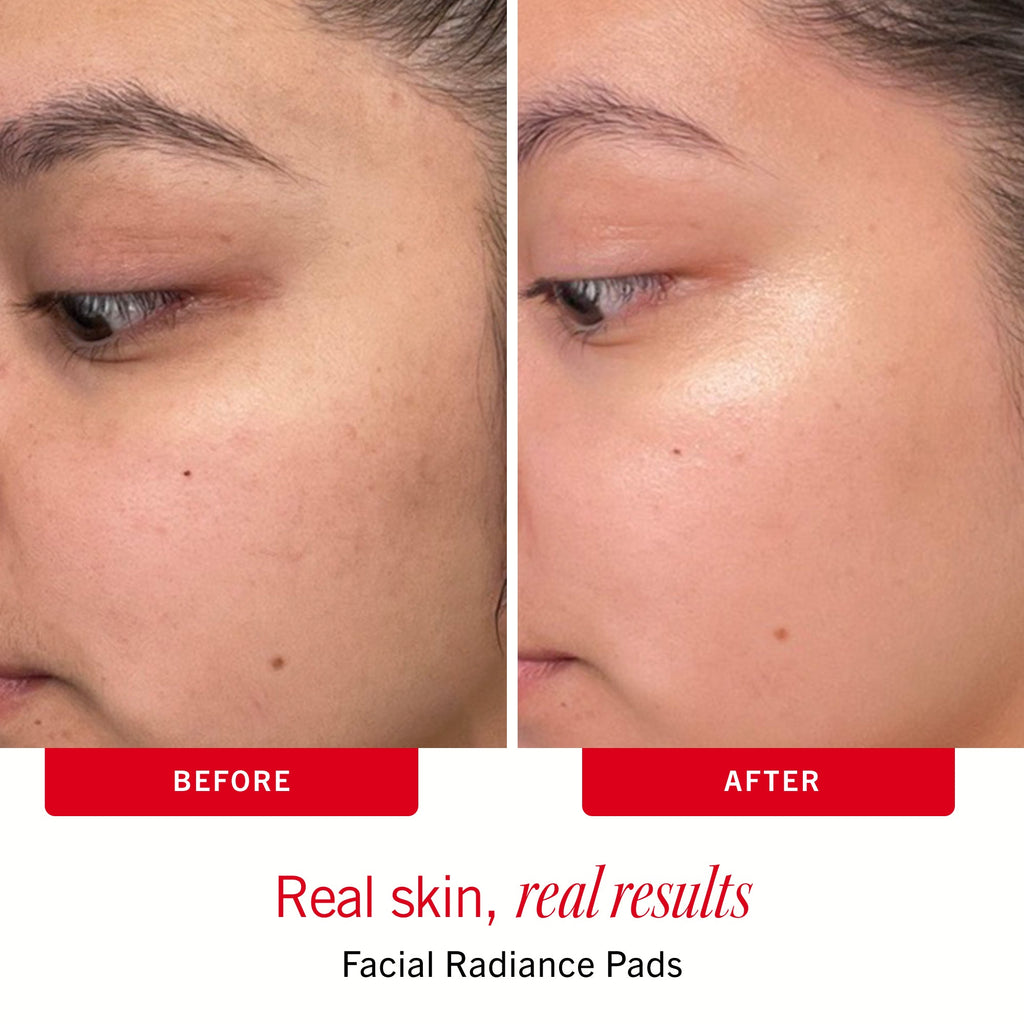 Sensitive Skin Bestsellers