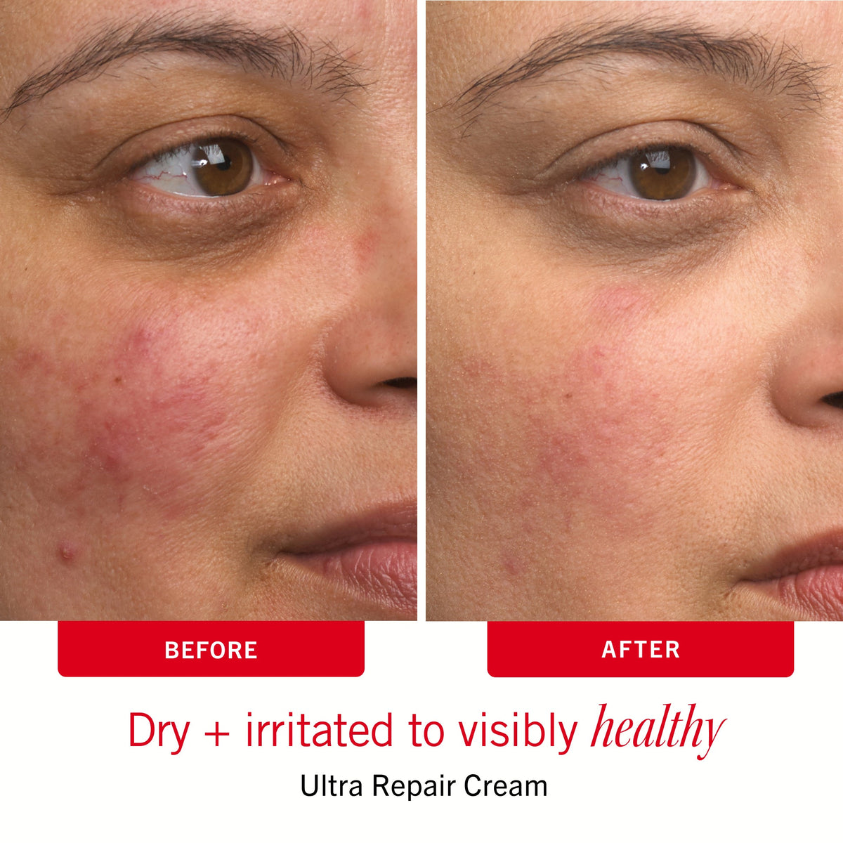 Sensitive Skin Bestsellers