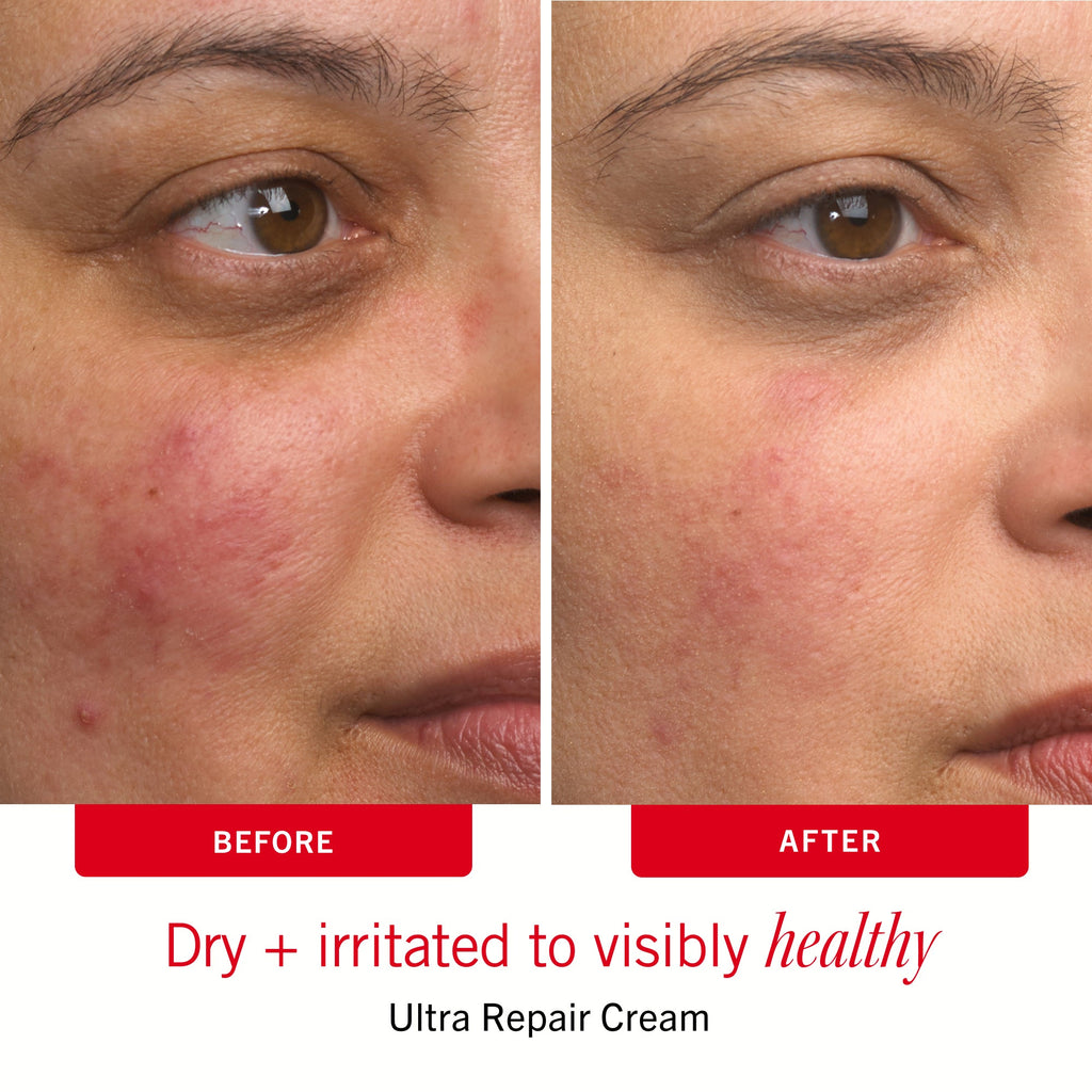 Sensitive Skin Bestsellers